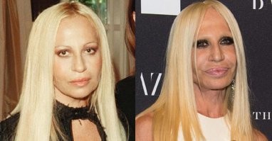 Давайте еще Донателлу Версаче вспомним