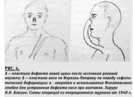 Автор хоть бы картинок нагуглил