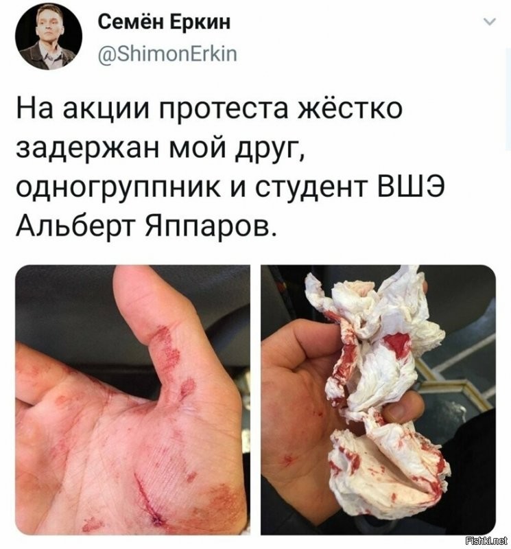 а это, Альбертик, начались у тебя критические дни.
ибо носитель худо-бедно небольших яйчишек на такие мелочи внимания не обращает.