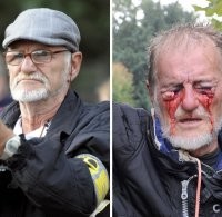 А уж в Германии, так вообще все для людей, подумаешь водометиком глаза выбили. Зато не фашисты, как в России.  .