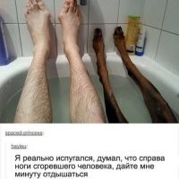 чуваку к врачу надо по ступням