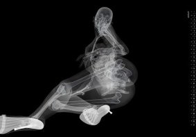 Рентгеновские снимки, которые открывают мир с неожиданной стороны