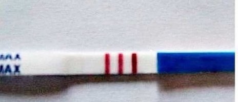 Ещё хуже когда три полоски.