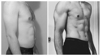 интересно, как ему удалось переместить родинки по телу ?