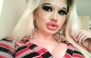 Уважаемая, я конечно понимаю, что женская солидарность и всё такое, но есть одно маленькое, но весьма весомое НО:
обычно, да что там обычно, в 9 случаях из 10 женщины сами ложатся под нож, чтобы модернизировать себе губы, жопы, ну и сиськи разумеется.
Это в принципе невозможно, если "особь мужского пола" после усталого рабочего дня приходит домой, смотрит на свою спутницу жизни и говорит:
-Дорогая?! А не увеличить ли тебе губы, что ты как чмошница в самом то деле, а?
У меня знакомая работает семейным психологом, и несложно будет догадаться, но львиная доля её клиентуры это женщины с протекающими чердаками...
И как раз с хреновой кучей комплексов те самые женщины и начинают себя уродовать  увеличивая губы, жопы, сиськи, в том числе доводя себя анорексии.
Легко конечно во всех смертных грехах винить мужчин, но к сожалению бабы частенько просто дуры, и в их дурости медицина зачастую бессильна