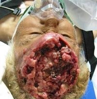 она и раньше была заряжена глистами. Просто открыли это относительно недавно. Там не только глисты, там ещё и черви всякие. Японцу вон, мозг сожрали. Суши любил. Именно поэтому нормальные люди рыбу варят\жарят\замораживают и т.д., а не жрут сырой