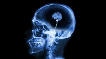 У чувака вместо мозга грецкий орех. Максимум