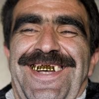 Контрабандисты прикрыли лысины золотом, но что-то пошло не так