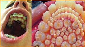 "Всё нормально," - говорили они - "никаких побочных эффектов"