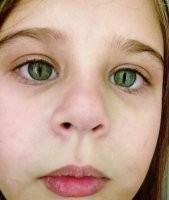 Сдается мне, что эта аномалия не "кошачий глаз", а "человечий песдеж"!