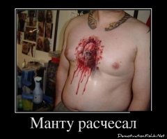 .
- Давайте поговорим о прекрасном?! Вот у Вас есть глисты?

- Нет... О_о

- Вот и прекрасно! :-)

.