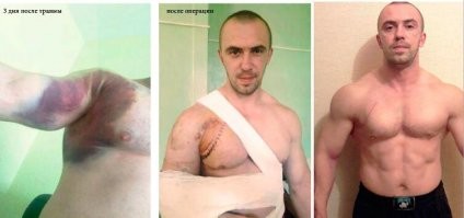 Да ладно......  Про разрыв грудных мышц никогда не слышали?