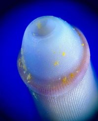 Это точно игла?