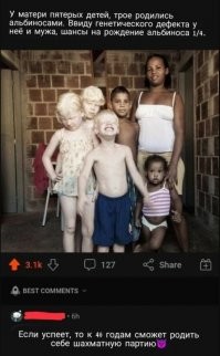 У пацана даже глаза не выдерживают переизбытка белого