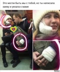 картинка, безусловно, очень смешная. Но давайте позанудствуем.
Девушка.
Такая повязка не накладывается при гематоме от удара, и тем более, при переломе челюсти. Это либо повязка после удаления родинки/жировика, либо у девушки начался "флюс" и она себе сделала компресс.
Парень.
При ударе неподготовленным кулаком повреждается либо 1 фаланга пальцев, либо пястные кости. При это лангет накладывается с иммобилизацией следующих суставов. То есть, как минимум на 1/2 пальцы были бы загипсованы. Однако, у парня пальцы свободны, а значит, либо там просто бинт (рана в пределах кожи с тыльной стороны ладони - вывернутой рукой пощечину по левой щеке не выпишешь), либо гипс на предплечье, а значит, об эту девушку он себе травму не наносил.