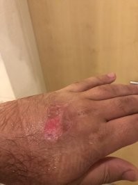 Главное в этот деле, это соблюдать ТБ.