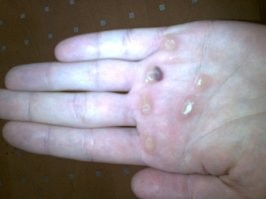 Что будет если ..? Что то из этого ... или сначала одно , а потом и другое !