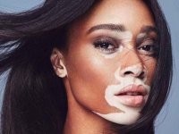 Ну, двухцветные бывают :)



А конкретно в моём примере говорится о мутации. Мутация - это не трёхцветный окрас шерсти, а наличие трёх половых хромосом вместо двух у кота. И, соответственно, у людей.
Цвет кожи с половыми хромосомами не сцеплен. У человека я помню всего один признак со сцепленным наследованием, который не является заболеванием (это всякие дальтонизмы, гемофилии, ихтиозы и прочие, которые передаются сцеплено).

Это - рост волос у человека в ушах.