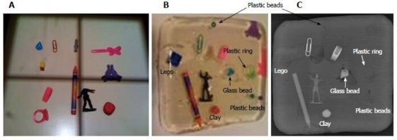 Images of foreign objects. A: Color photograph before embedding in gelatin; B: Color photograph after embedding in gelatin; C: Plain X-ray taken with objects embedded and placed on water-equivalent phantom.