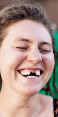 Представляю, приходишь на работу и там зуб "молочный" с коллегами вырываем)))