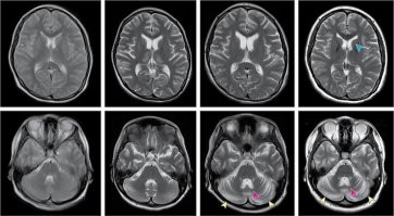А не надо верить, есть МРТ
А те, кто разрабатывал регламент продажи оружия, кто давал справки -  к ним много вопросов, согласен.