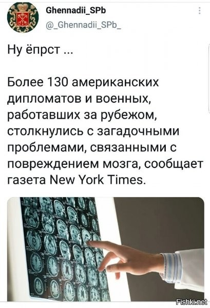 Ничего необычного!
Постоянная потребность ЛГАТЬ и регулярное потребление этодругина вызывают необратимые повреждения мозга.  Атрофируются зоны ответственные за честь, совесть, ...  Поражается до 90-95% мозга.
ПОциент впадает в неконтролируемый псакинг.
Собственно, Таймс только подтвердило то, о чем давно говорят вменяемые люди.