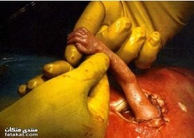 Не зная насколько это правдоподобно с позиции медицины, но была интересная и трогательная серия где то в 3-м сезоне вроде... где даже сердце Хауса растаяло...