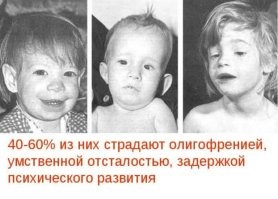 Да мне если честно покуй. 
Бухай, рожай детей, не мне их воспитывать.