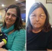 Зато у мамы морщины разгладились