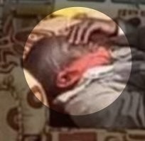 Что у него с лицом?