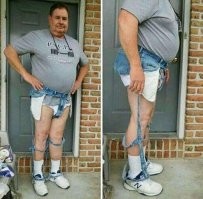 Рваные джинсы опасны в жару