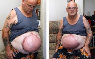 Осторожно! Массовые жалобы  на болезнь купальщиков