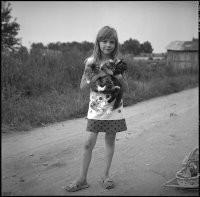 У меня в 80-х такие же коленки были. 
Жизнь настоящие образ жизни не изменился.