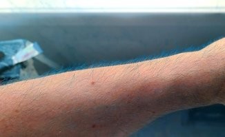 Прикольно. Так, глядись, и зародится модный тренд. Волосы подмышками уже красят некоторые бодипозитивные, а скоро ноги-руки увидим
