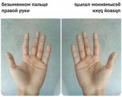  Люди с биологическими аномалиями: не мутация, а особенность