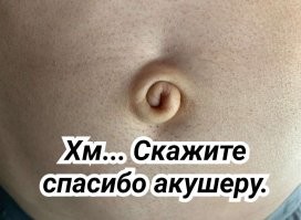  Люди с биологическими аномалиями: не мутация, а особенность