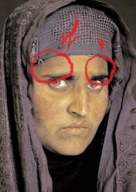 вы хотите сказать что ей всего около 30 лет! и на лобной части растут волосы! на меня смотрит женщина возрастом 45-50 лет