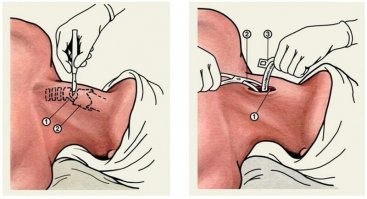 Одна из единственных, которую бы хорошо бы знать. Но без отображения что там под цифрами - бессмысленно.