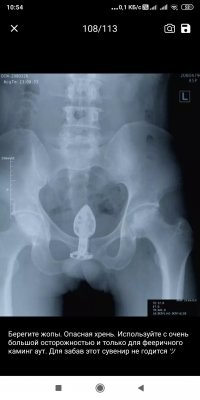 Аккуратно с этим