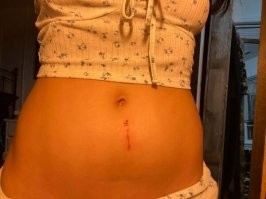 У мужчин бывает больнее.