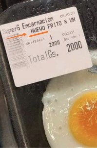 14 людей, которые оказались настолько ленивы, что даже в носу за них чешет кто-то другой