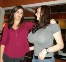 Такому не завидуют. Огромная грудь - несчастье для женщины.