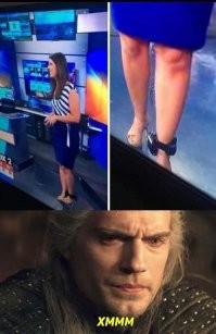 Что болит? - Голова... - А почему повязка на ноге? - Сползла...