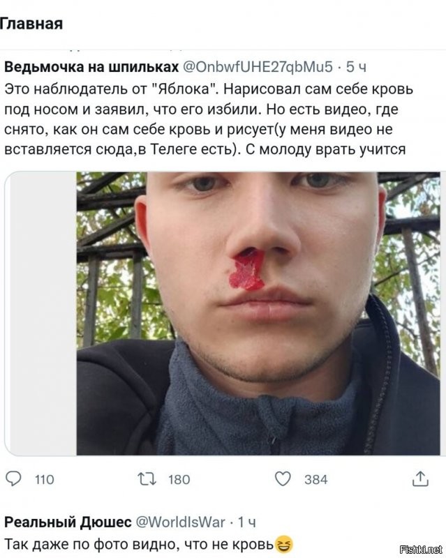Этот мудак явно никогда в пятак не получал. Жаль что рядом никто ему наглядно не показал как рыльце после получения в торец выглядит.