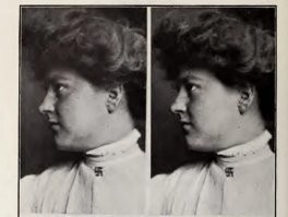 Мне кажется или у неё пуговица свастон