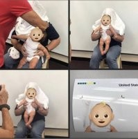 Что у ребёнка с головой?