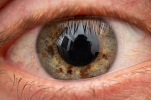 Судя по его красному глазу, тетка, что фотографирует, заставила его не моргать очень долго))))