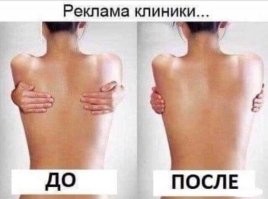 22 примера жгучей рекламы, которая покажет как надо думать мозгом