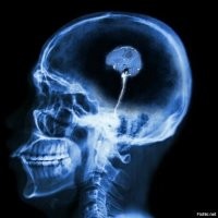 Скорее дело в прокладке с погремушкой в коробке вместо серого вещества.