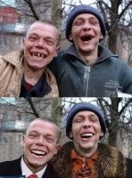 Исследователи нашли средство, которое позволяет вырастить новые зубы